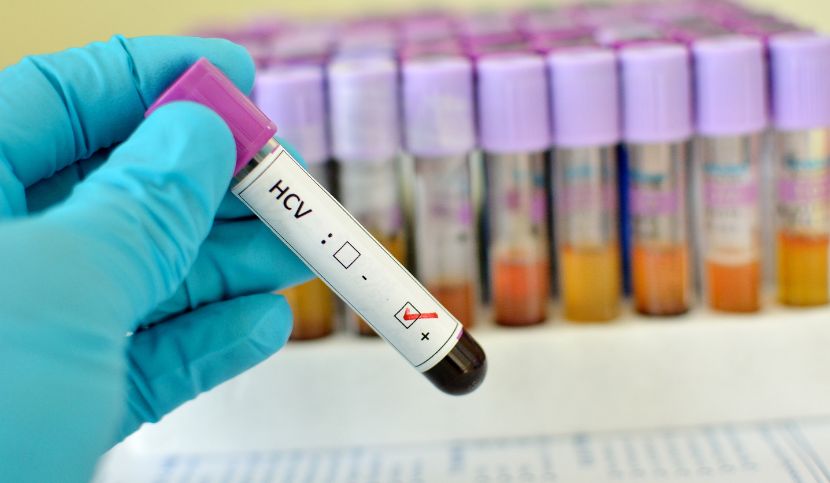 Concorso-di-cause-naturali-e-condotta umana-HCV
