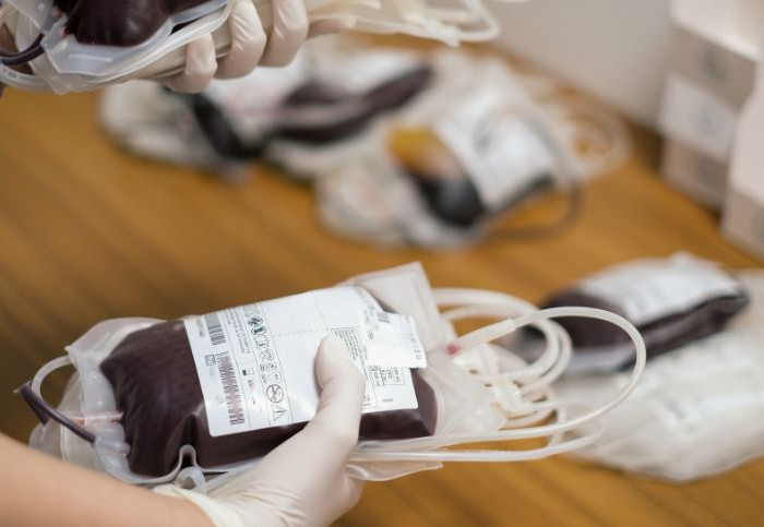 contagio-hcv-trasfusione-sangue-infetto