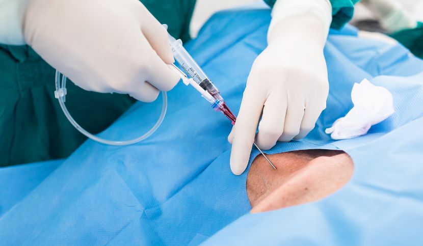 Embolia-gassosa-venosa