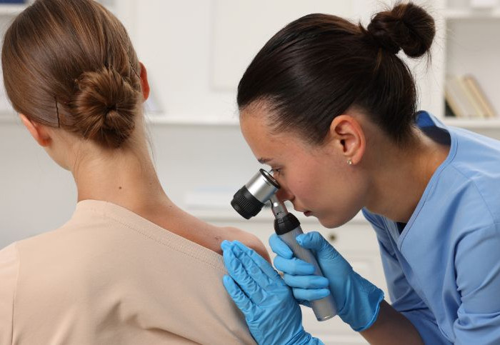 cure-alternative-melanoma