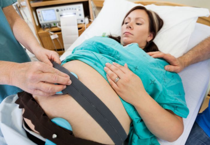 ostetrica-condannata-monitoraggio