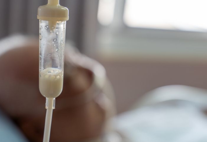 perdita-chance-sopravvivenza