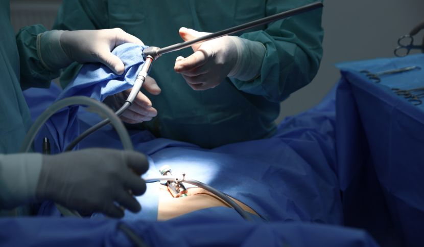 Plessopatia-post-operatoria