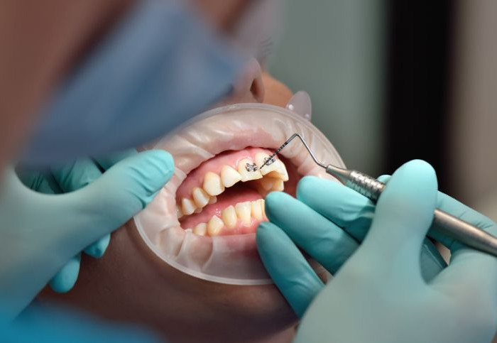 Responsabilità-odontoiatrica