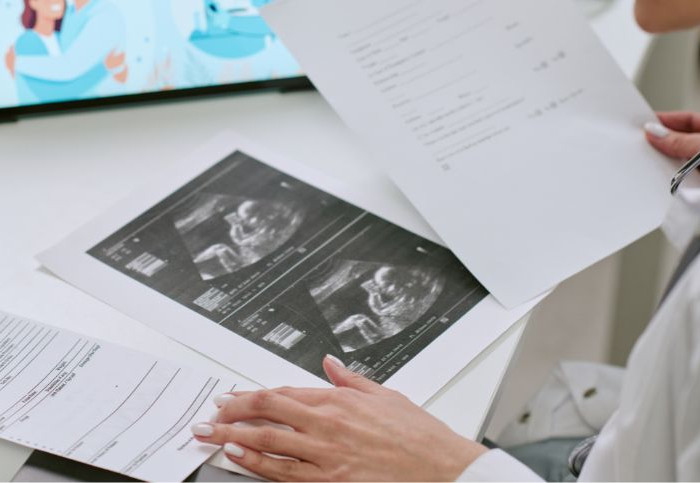 mancata-diagnosi-prenatale